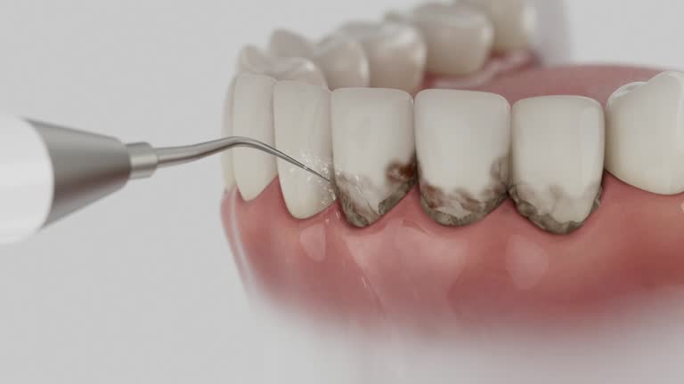 Reliable Emergency Dentist contractor in Gruver, TX by Smile Center Dentistry